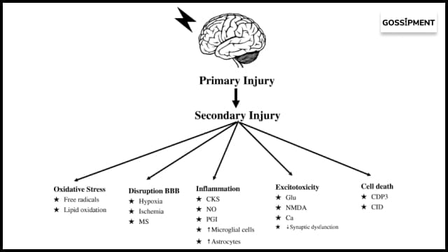  WHAT IS Head Trauma